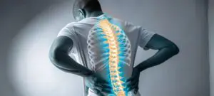 Neuropathische Rückenschmerzen - Cannabis