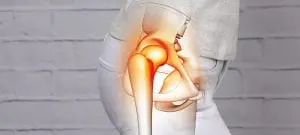 Arthrose Symptome Arthrose Symptome