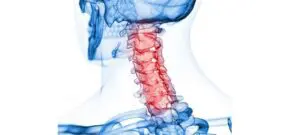 Halswirbelsäule HWS