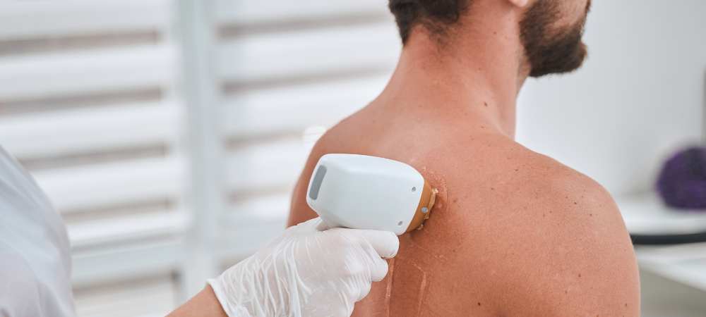 Rückenhaare entfernen